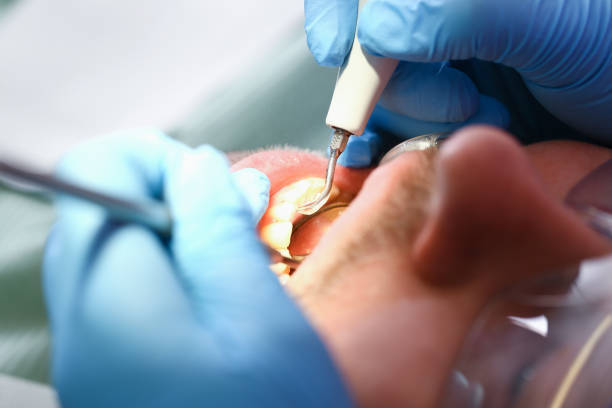 Best Same-Day Emergency Dental Services in Earlvle, IL